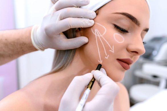 Facelift in Madrid, Improves the Signs of Aging on the Face