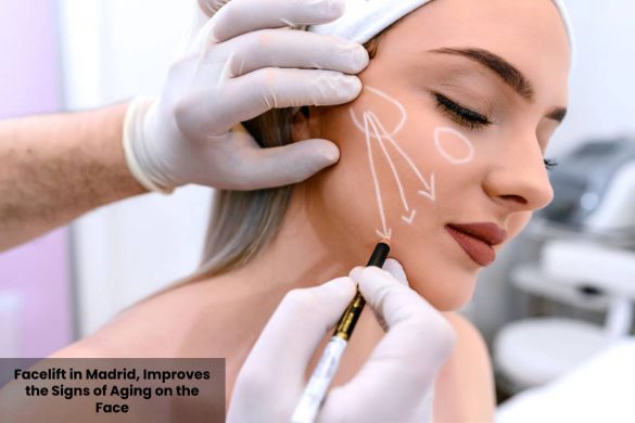 Facelift in Madrid, Improves the Signs of Aging on the Face