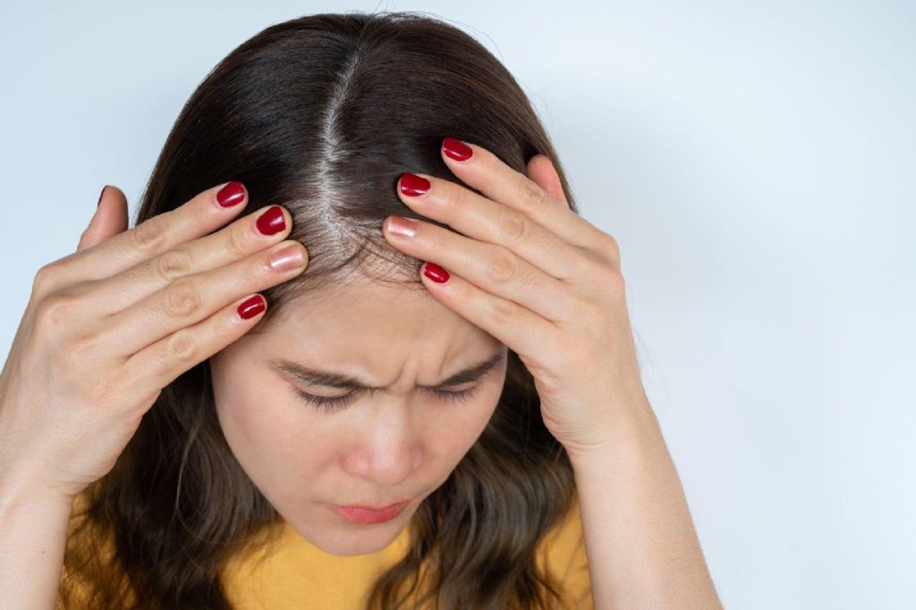 Female Pattern Baldness