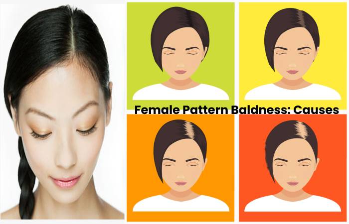 Female Pattern Baldness_ Causes, Treatment, and More (1)