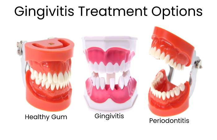 Gingivitis Treatments and Medications (2)