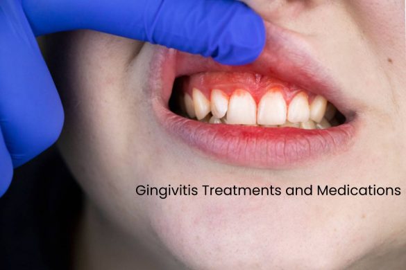 Gingivitis Treatments and Medications