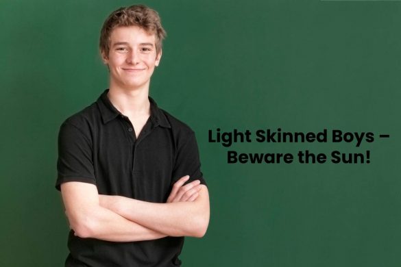 Light Skinned Boys – Beware the Sun!