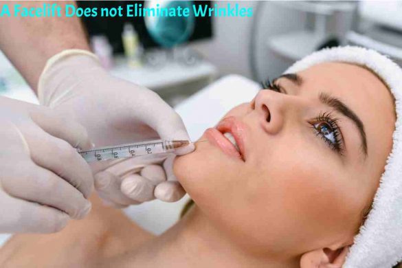 A Facelift Does not Eliminate Wrinkles