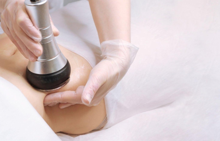 Ultrasonic Cavitation