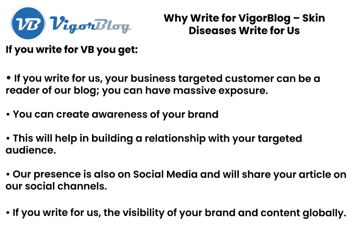 why write for us vigorblog 