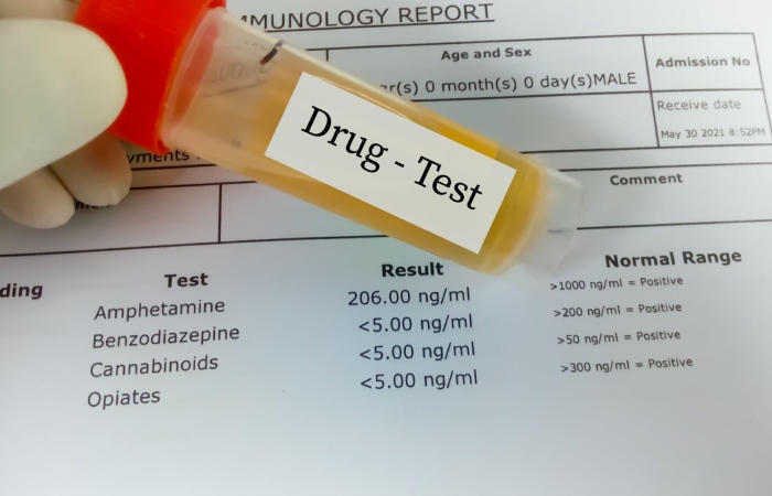 What Are Drug Tests_