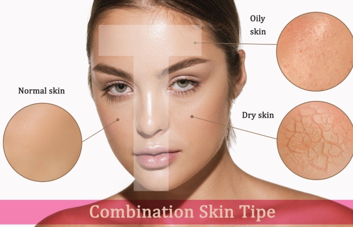 What Are The Different Types Of Skin Types_