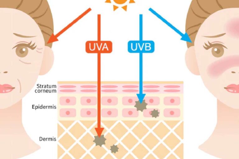 Does Blue Light Impact Your Skin