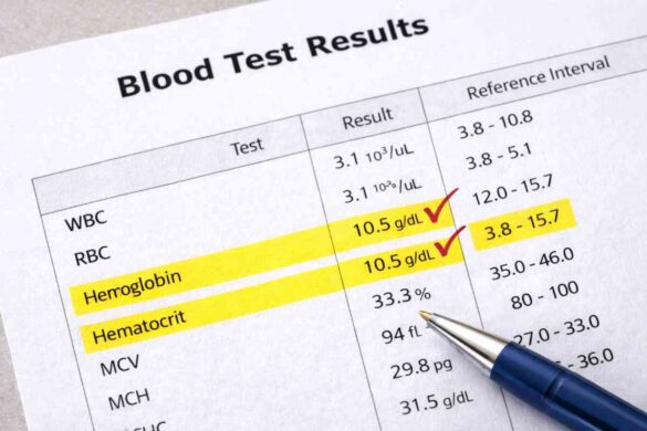 Blood Test Results Explained: What Doctors Really Look For